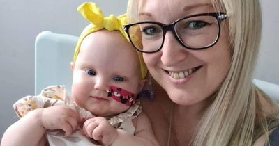 Baby's brain tumour detected after mum notices extraordinary growth on her head