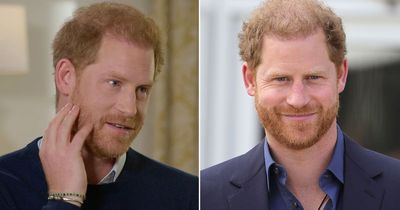 Prince Harry fans baffled he had to get permission from the Queen to keep his beard
