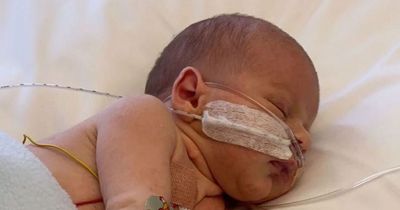 Baby spent the first four months of life in hospital after needing heart surgery