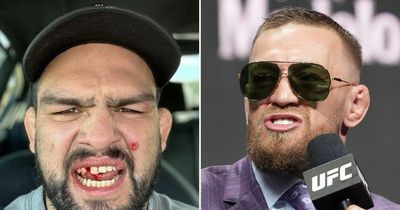 Conor McGregor tells UFC rival to see a doctor about "hole in his face"