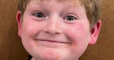 Boy, 11, has scalp torn off after he is viciously attacked by three pit bulls