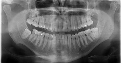 Age-checking child asylum seekers with X-rays could put them at risk, experts warn