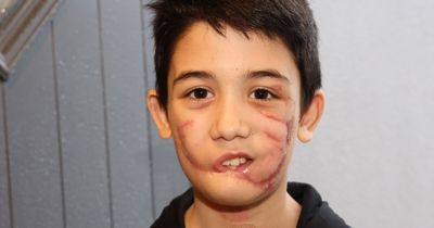 Brave boy home from hospital after dog attack as family say 'nightmare is over, it's a dream for us'