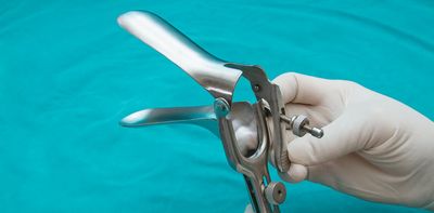 Speculum: the creepy history of this ancient gynaecological device and why it’s still feared today