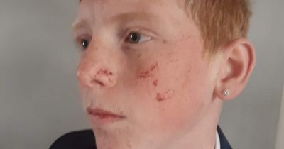'Children got out their phones to film pre-planned attack on my son'
