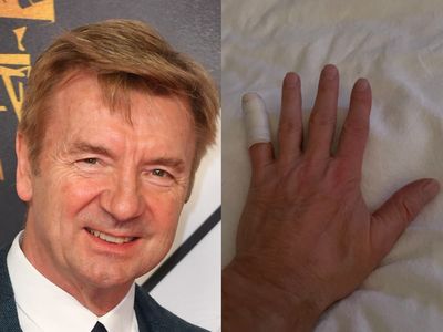 ‘Broken’: Dancing on Ice star Christopher Dean suffers sudden injury days before series begins