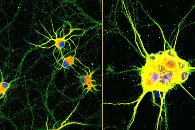 Lab grown nerve cells ‘holds promise for neurodegenerative disease’