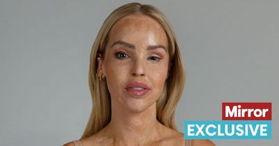 Katie Piper 'honoured' as she launches inspiring project with 'unseen' stars