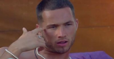 Love Island fans in tears as Ron shares football accident that led to blindness in one eye