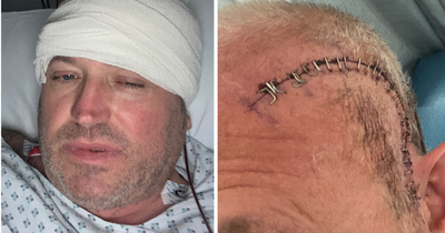 Dad rushed to hospital with ear infection finds out he has inoperable brain tumour