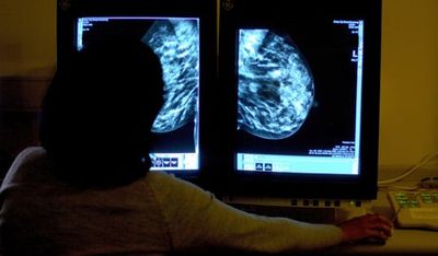 Tech & Science Daily podcast: Breast cancer research breakthrough