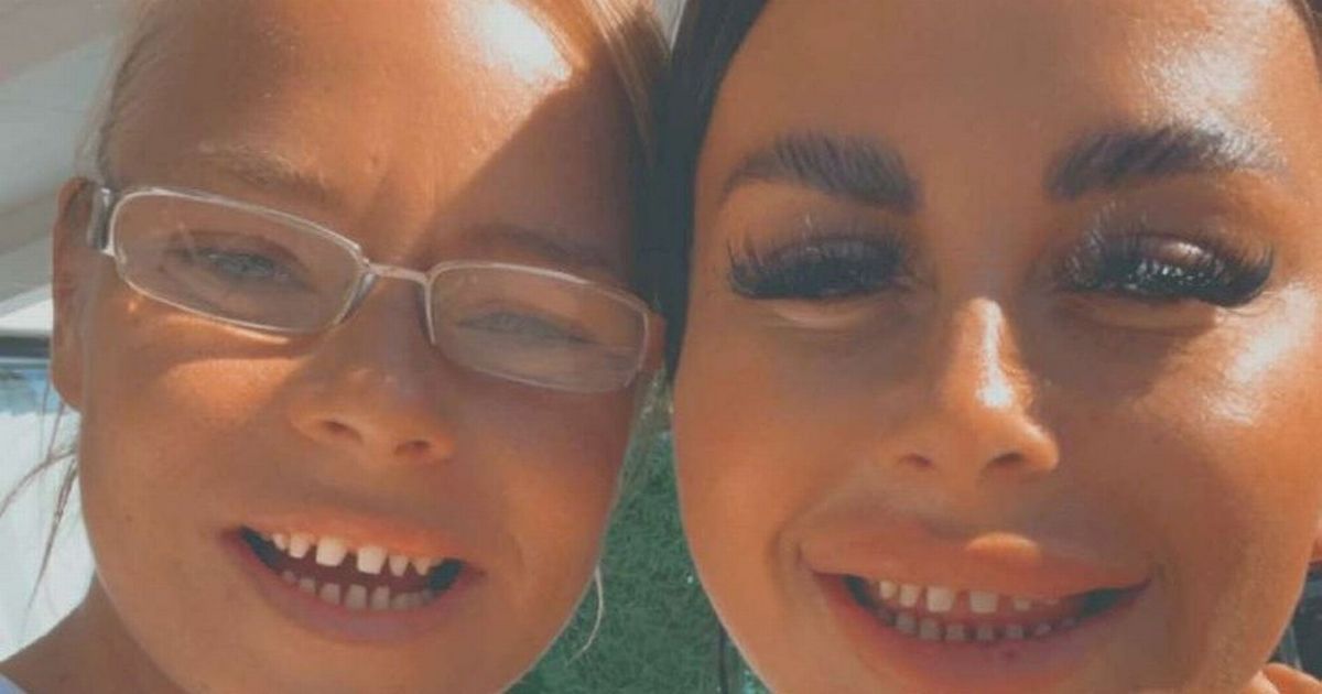 Our Turkey Teeth Cost Us 4 000 And Look Lovely But