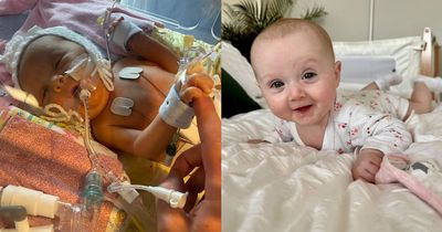 Baby born with dead bowel was expected to die within hours, but now family 'cries happy tears'