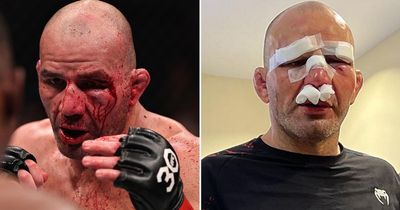 Glover Teixeira shows off bandaged face after brutal UFC 283 title fight