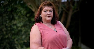 Mum had to have arm sewn into stomach after friend's dog mauled her for 45 minutes