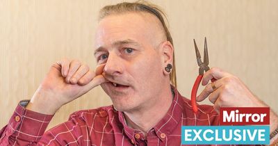 Desperate man who couldn't get NHS dentist pulls out 5 of his teeth with pliers