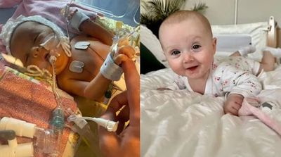 Doctors save life of baby with ‘miracle’ rare surgery at St George’s Hospital in south London