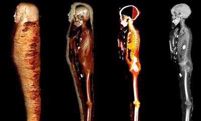 Digital scan unwraps secrets of mummy from 2,300 years ago