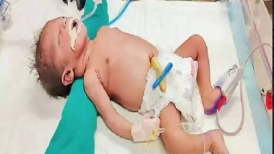 Day after birth, 'Border', born to Pakistani mother, dies of lung infection in Amritsar