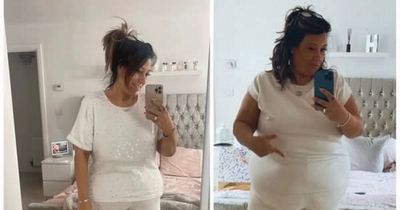 Mum-of-five who 'yo-yo dieted whole life' sheds eight stone after Turkey trip for gastric operation