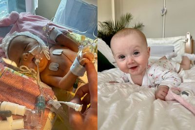 Baby given hours after being born with ‘dead bowel’ defies doctors