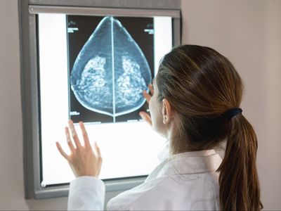 Few women are aware that breast density is an increased risk factor for cancer, new study shows