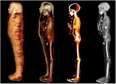 2,300-year-old mummy named ‘Golden Boy’ digitally unwrapped