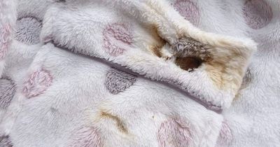 New electric blanket caught fire as woman sat with it on her knee