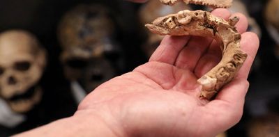 Fossil teeth reveal how brains developed in utero over millions of years of human evolution – new research