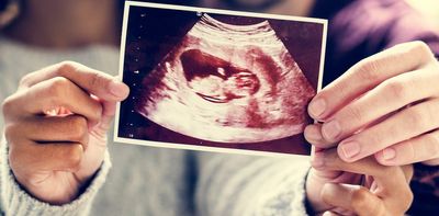 Claims that foetuses are surrounded by bacteria in the womb are incorrect – new review