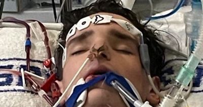 Welsh teenager put in coma and nearly died after contracting flu