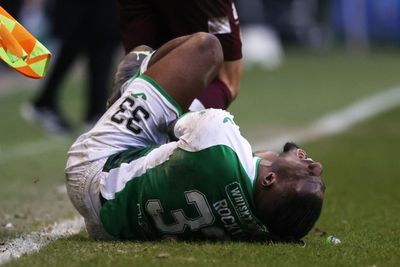 Rocky Bushiri injury confirmed with Hibs to be without defender for three months