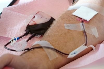 FDA eases rules again for gay men seeking to donate blood