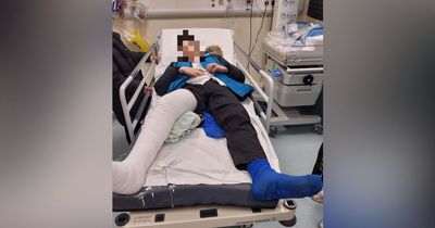 Boy, 12, left in agony and facing MONTHS off school after being hit by car