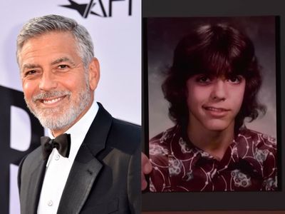 George Clooney reveals he had Bell’s palsy as a teenager