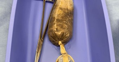 Man swallows whole banana wrapped in CONDOM in 'fit of rage' before doctors dig it out