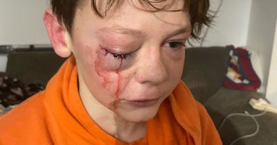 12-year-old boy brutally beaten in park 'by man and teenagers'