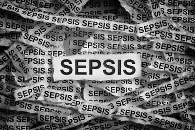 Five signs of sepsis you need to know and act on immediately