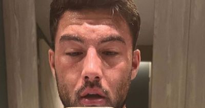 Love Island's Liam Reardon suffers nightmare reaction after eating raw meat while on holiday