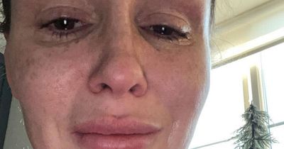 Chanelle Hayes posts crying selfies and says 'I'm not fine' as she shares health battle