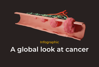 Infographic: A global look at cancer