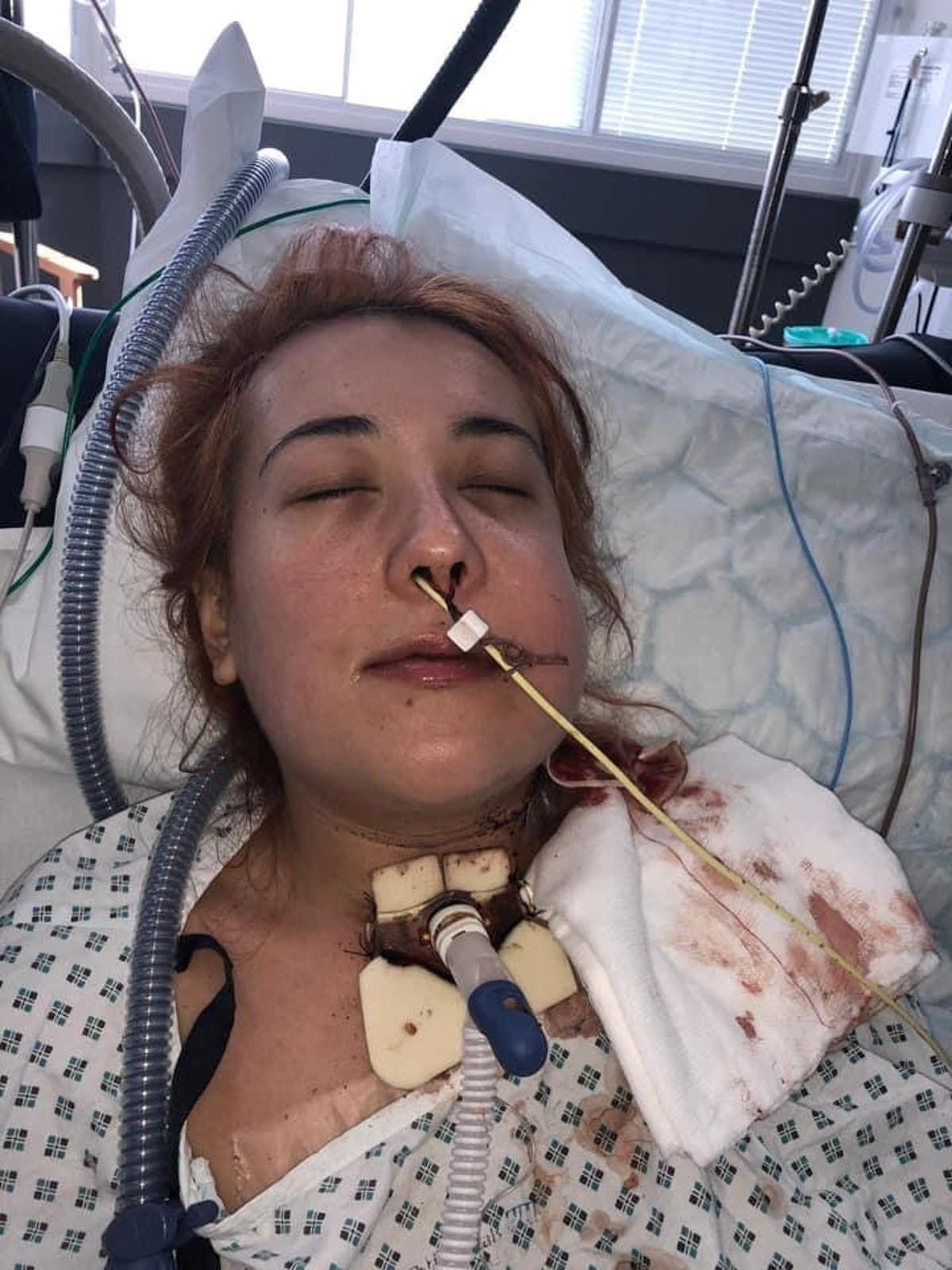 Woman who had lump in mouth for six years diagnosed…