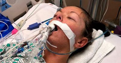 Woman put on life support for eight days thanks to vaping