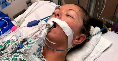 Woman says vaping addiction saw her on life support with life-threatening lung condition