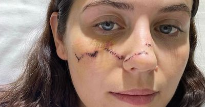 Backpacker slices her face open in moped crash during holiday in Thailand