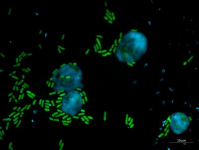 Molecule named after Keanu Reeves kills microbes ‘efficiently’, study says