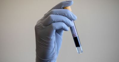 New prostate cancer blood test is 94% accurate, say researchers