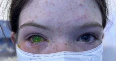 Insect blamed for mystery surge in 'life-changing' condition that alters eye colour