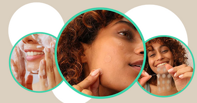 Amazon shoppers are loving 'best ever' £6 Acne Patches - with 35,000 five-star reviews