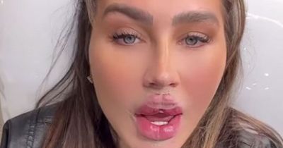 Lauren Goodger joins Katie Price and reveals new 'butterfly lips' after tweakment